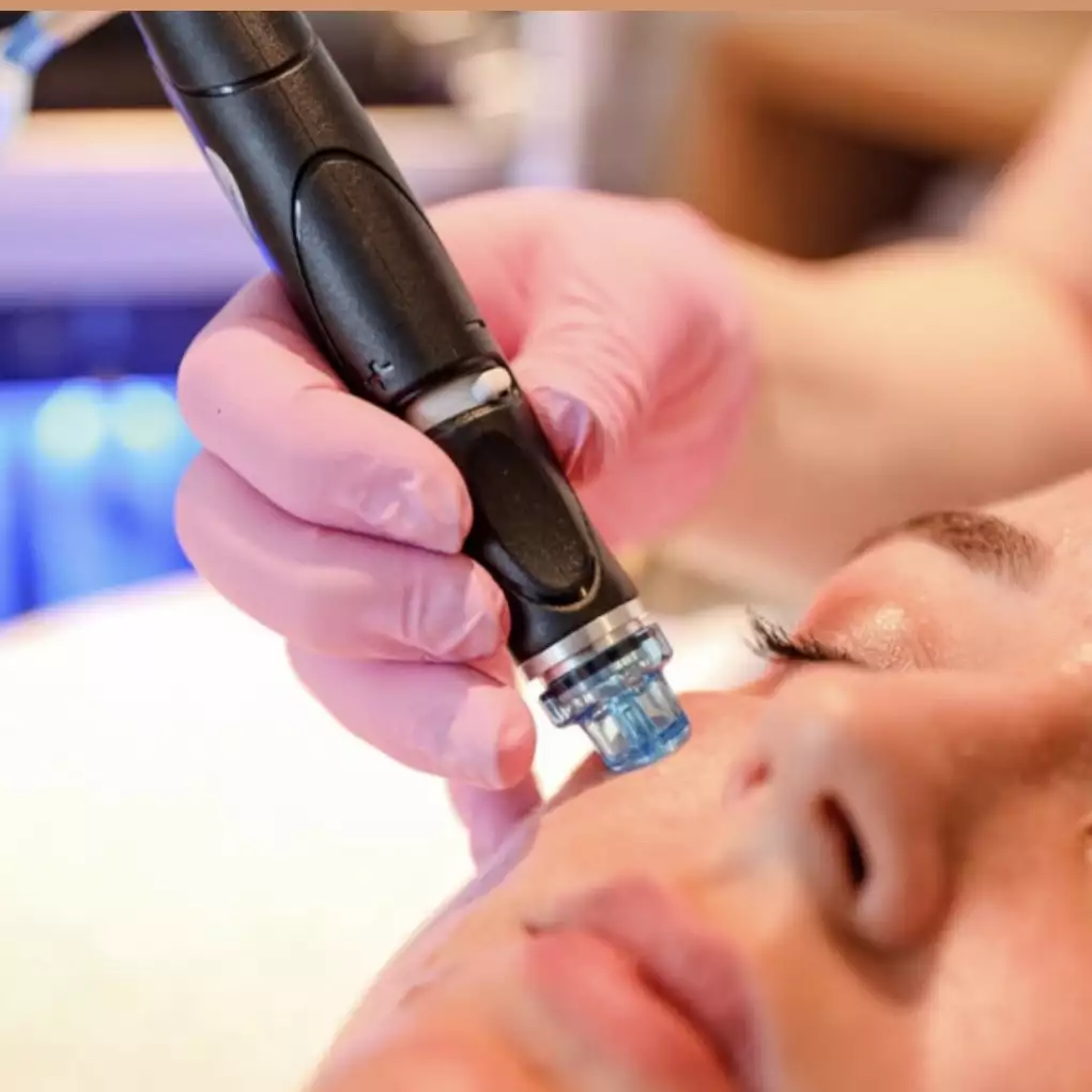 hydrafacial6 -  - HydraFacial